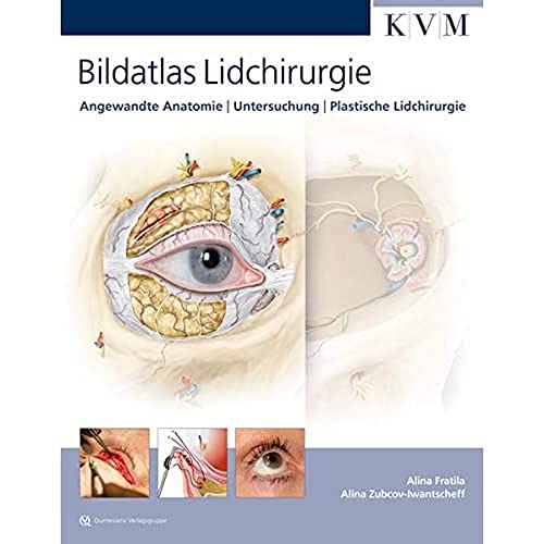 Bildatlas Lidchirurgie: Angewandte Anatomie | Untersuchung | Plastische Lidchirurgie